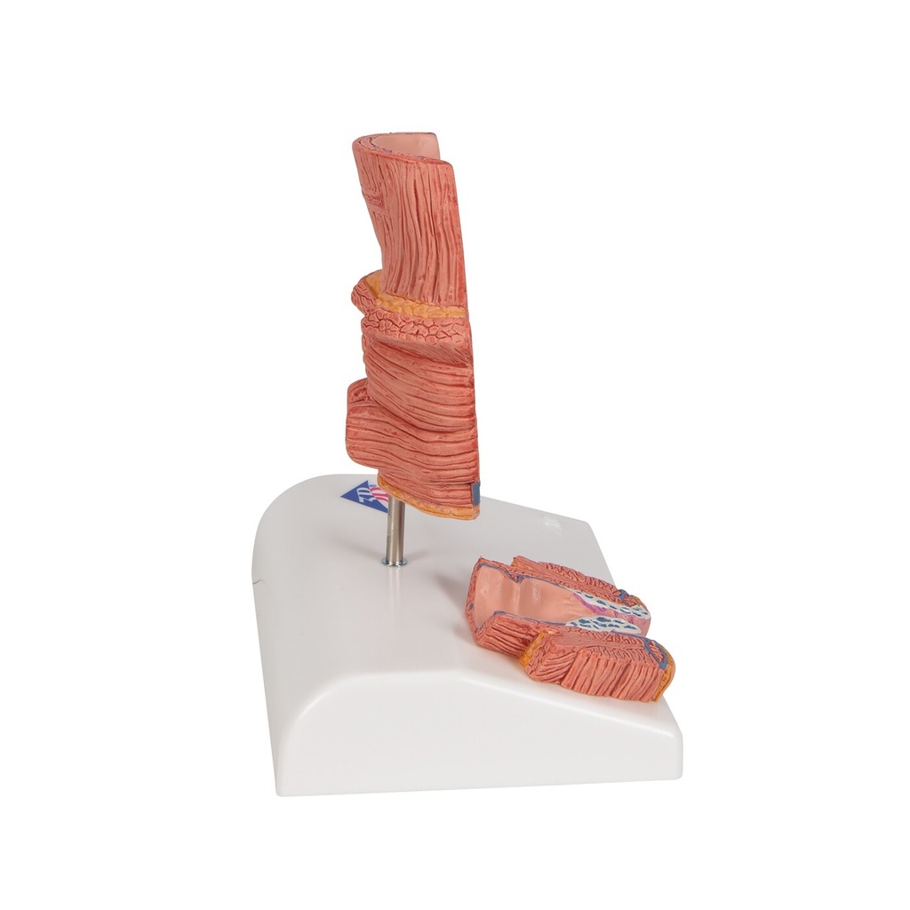 Hämorrhoidenmodell Hämorrhoidenmodell