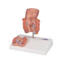 Hämorrhoidenmodell Hämorrhoidenmodell