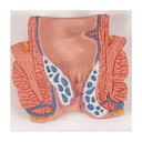 Hämorrhoidenmodell Hämorrhoidenmodell