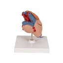 Herzmodell Klassik mit Thymus, 3-teilig Herzmodell Klassik mit Thymus, 3-teilig