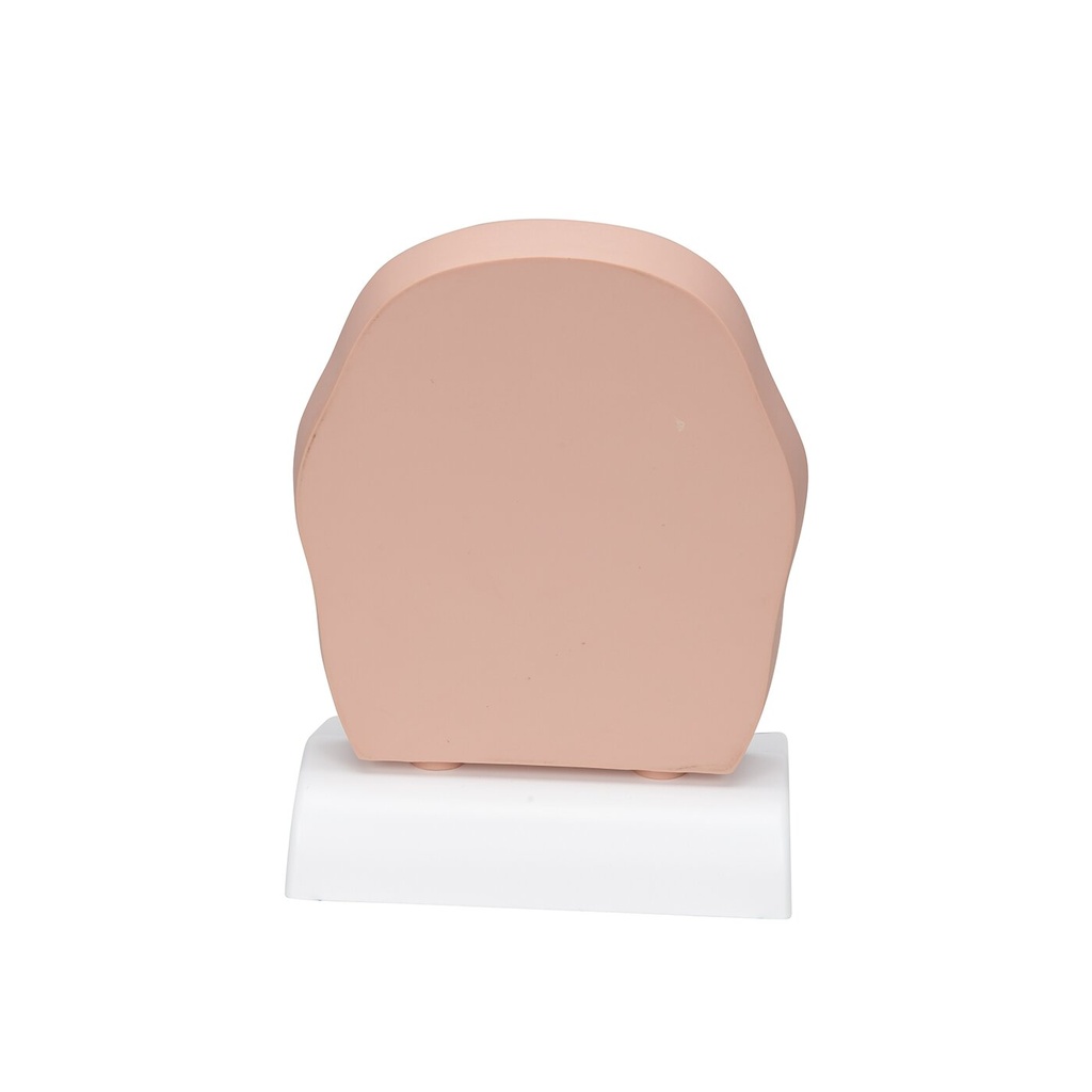 Kopfmodell frontal geschnitten in anatomischer Höhe der Nasennebenhöhlen (mit Sinusitis) Kopfmodell frontal geschnitten in anatomischer Höhe der Nasennebenhöhlen (mit Sinusitis)