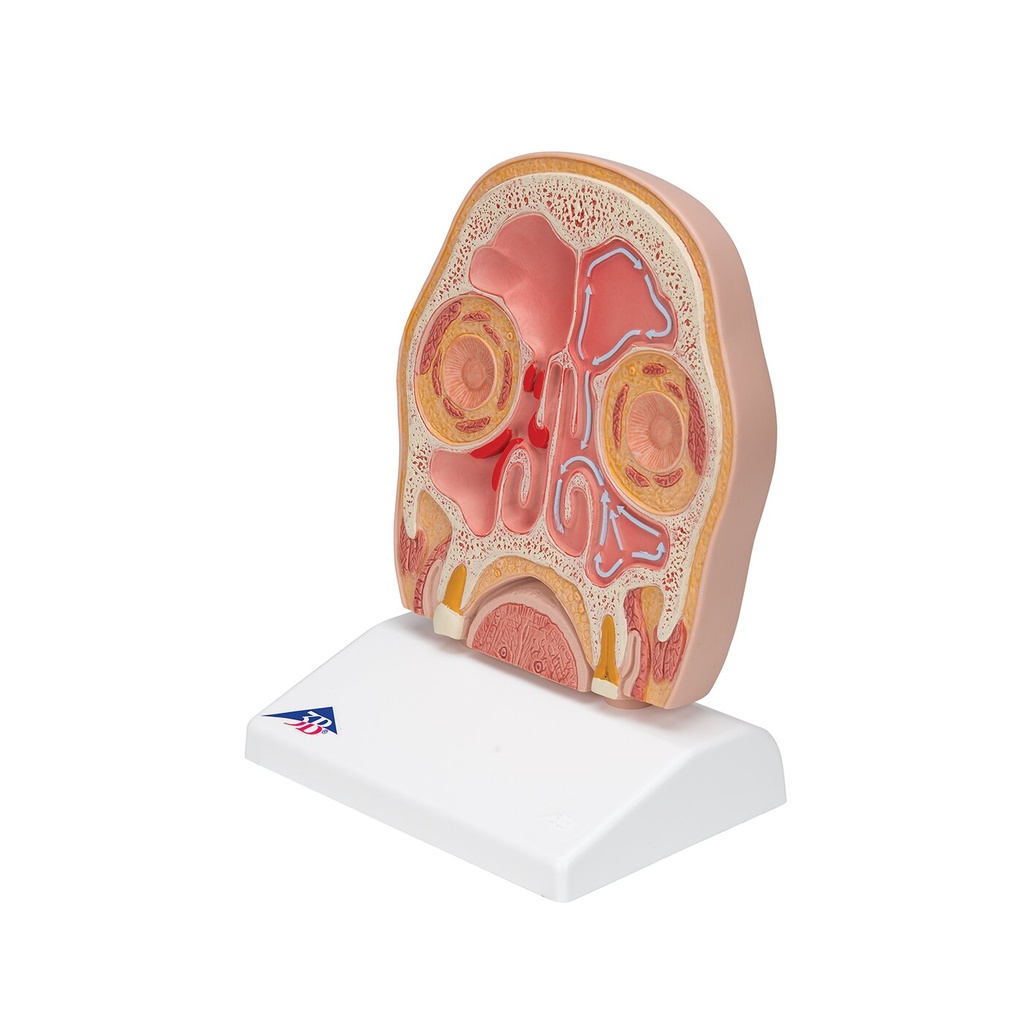 Kopfmodell frontal geschnitten in anatomischer Höhe der Nasennebenhöhlen (mit Sinusitis) Kopfmodell frontal geschnitten in anatomischer Höhe der Nasennebenhöhlen (mit Sinusitis)