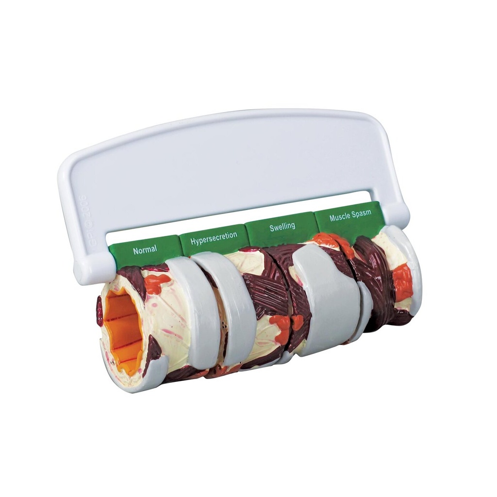 4-teiliges Bronchusmodell 4-teiliges Bronchusmodell