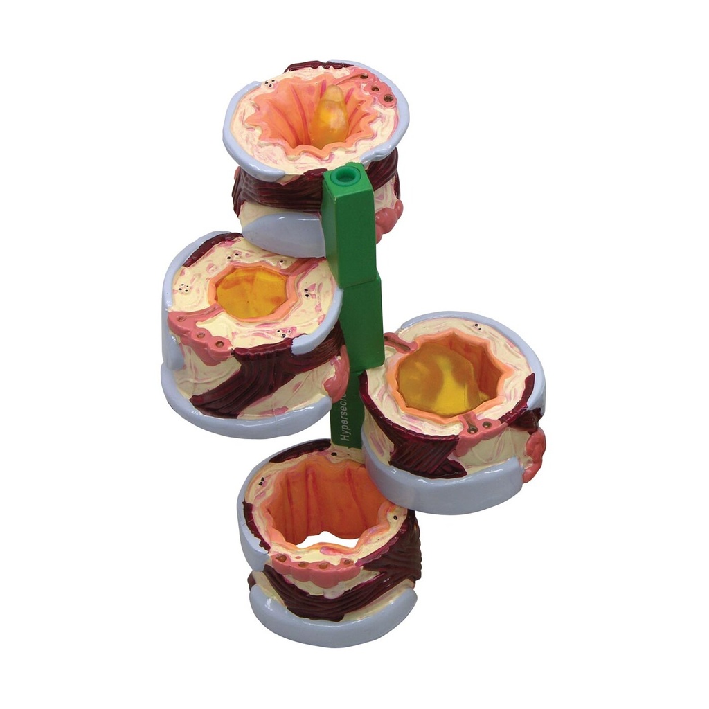 4-teiliges Bronchusmodell 4-teiliges Bronchusmodell