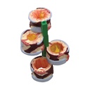 4-teiliges Bronchusmodell 4-teiliges Bronchusmodell