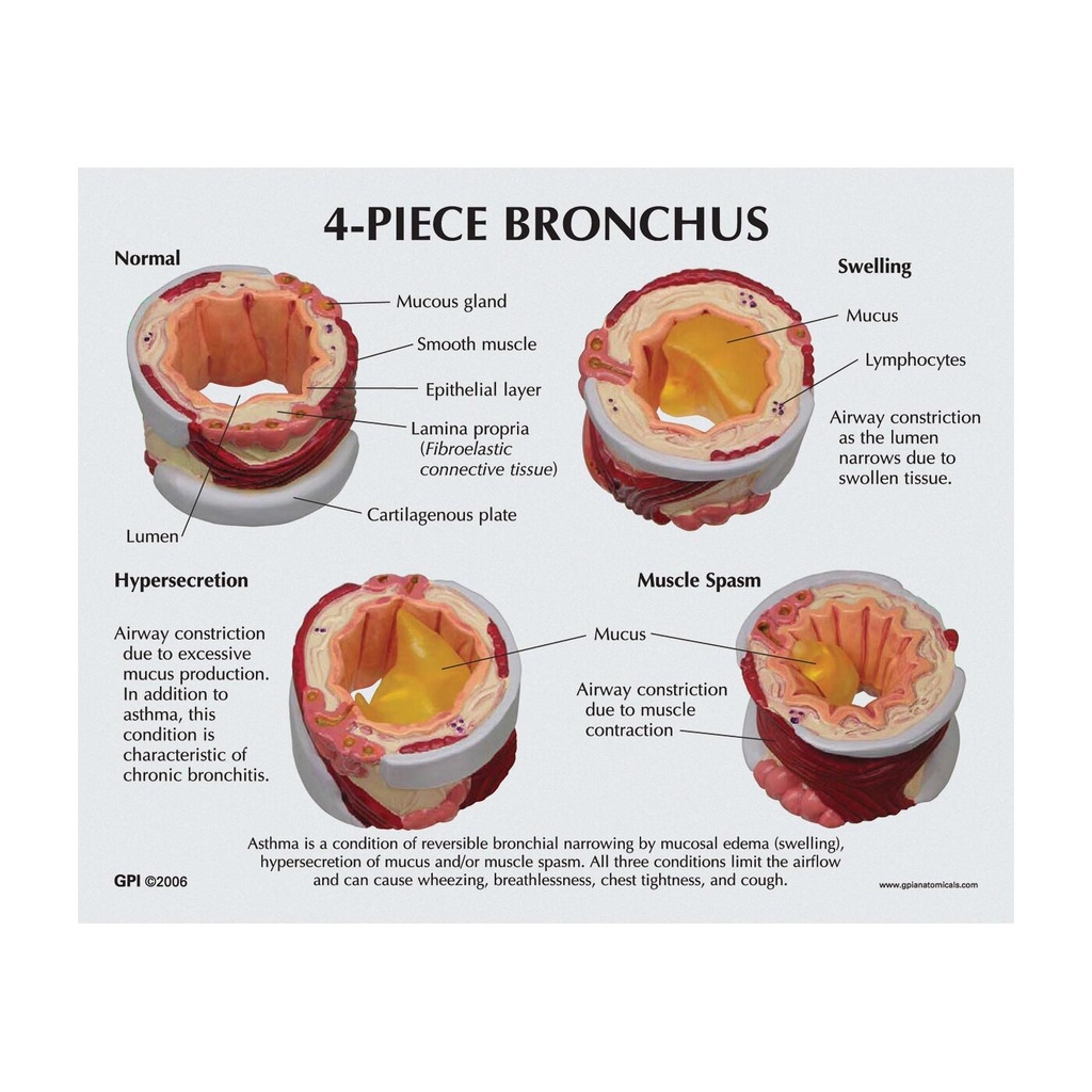 4-teiliges Bronchusmodell 4-teiliges Bronchusmodell