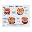 4-teiliges Bronchusmodell 4-teiliges Bronchusmodell