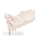 Atlas und Axis Modell, montiert, ohne Sockel Atlas und Axis Modell, montiert, ohne Sockel