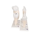 Zahnmodell Serie, 5 Modelle Zahnmodell Serie, 5 Modelle