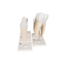 Zahnmodell Serie, 5 Modelle Zahnmodell Serie, 5 Modelle