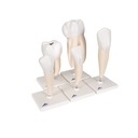 Zahnmodell Serie, 5 Modelle Zahnmodell Serie, 5 Modelle