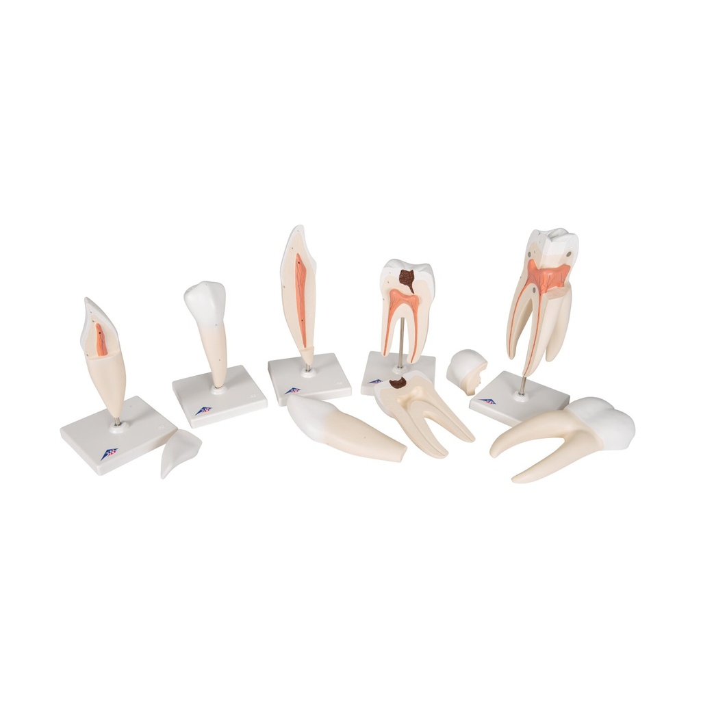 Zahnmodell Serie, 5 Modelle Zahnmodell Serie, 5 Modelle