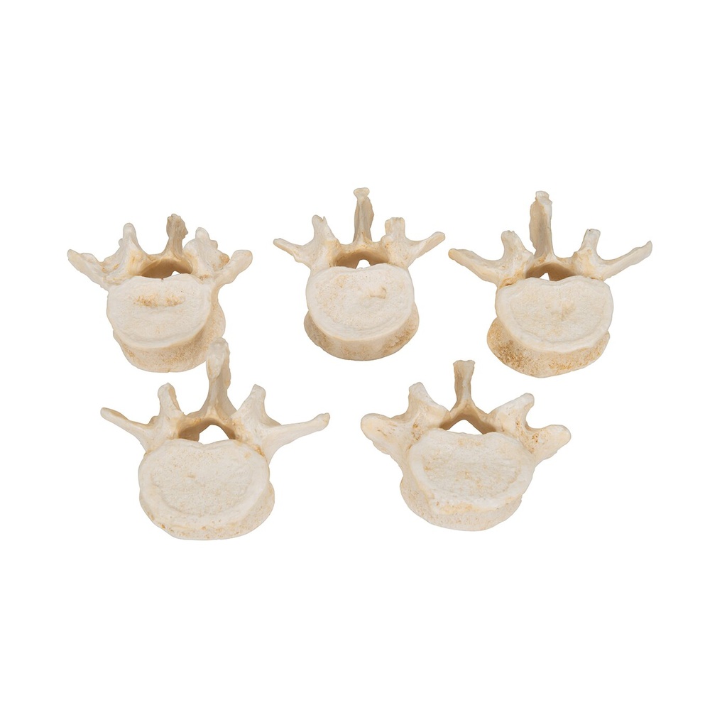 Wirbelmodell Set mit 5 BONElike™ Lendenwirbeln Wirbelmodell Set mit 5 BONElike™ Lendenwirbeln
