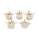 Wirbelmodell Set mit 5 BONElike™ Lendenwirbeln Wirbelmodell Set mit 5 BONElike™ Lendenwirbeln