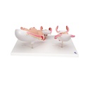 Schwangerschaftsmodell Serie, 5 Modelle Schwangerschaftsmodell Serie, 5 Modelle