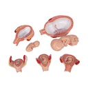 Schwangerschaftsmodell Serie, 5 Modelle Schwangerschaftsmodell Serie, 5 Modelle