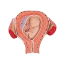 Fetus Modell, 3. Monat Fetus Modell, 3. Monat