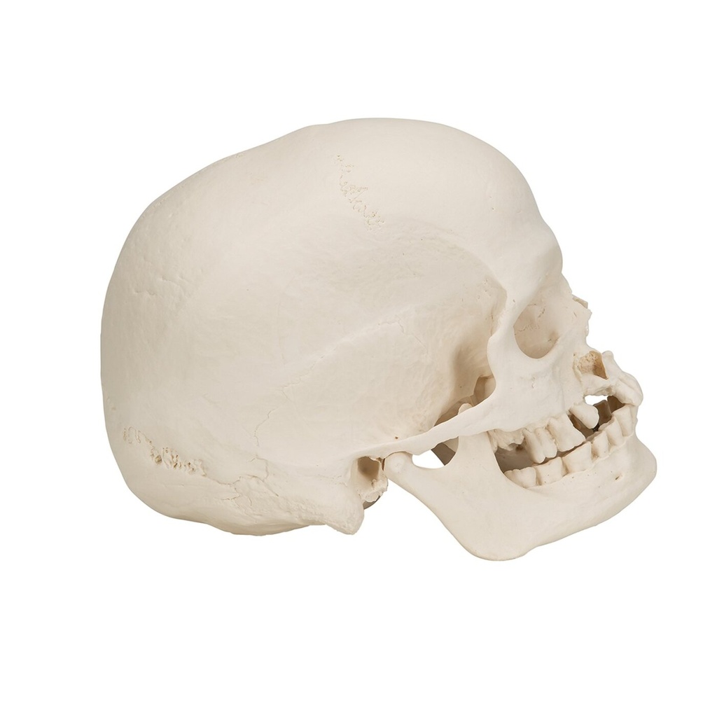 Mikrocephaler Schädel Mikrocephaler Schädel