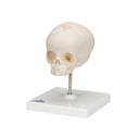 Fetus Schädel Modell, auf Stativ
