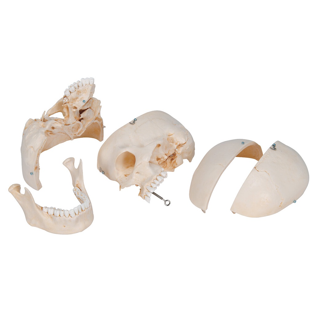 BONElike™ Schädel Modell mit median-sagittalen Schnitten, 6-teilig BONElike™ Schädel Modell mit median-sagittalen Schnitten, 6-teilig