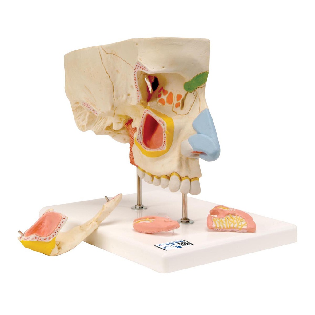 Nasenmodell mit Nasennebenhöhlen, 5-teilig