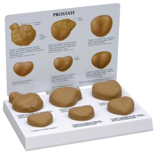 Prostatamodell