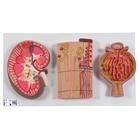 Modell Serie mit Nierenschnitt, Nephron, Blutgefässen & Nierenkörperchen