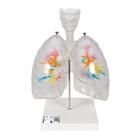 CT-Bronchialbaum Modell mit Kehlkopf und transparenten Lungenflügeln