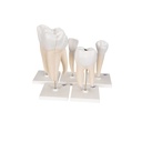 Zahnmodell Serie, 5 Modelle