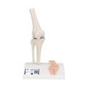 Mini Anatomie Modell Kniegelenk, mit Querschnitt
