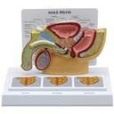 Modell Männliches Becken mit 3D-Prostata-Rahmen