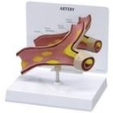 Arterienmodell