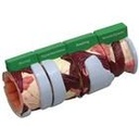 4-teiliges Bronchusmodell