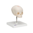 Fetus Schädel Modell, auf Stativ